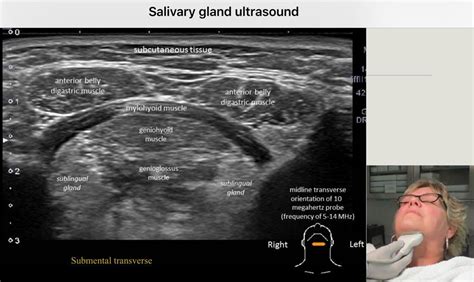 soft tissue ultrasound video